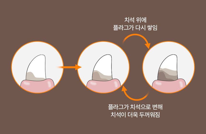 [NEW신상][무료배송] 개님의상점 중박스 개님의껌 가든레인져S 25p 7번째