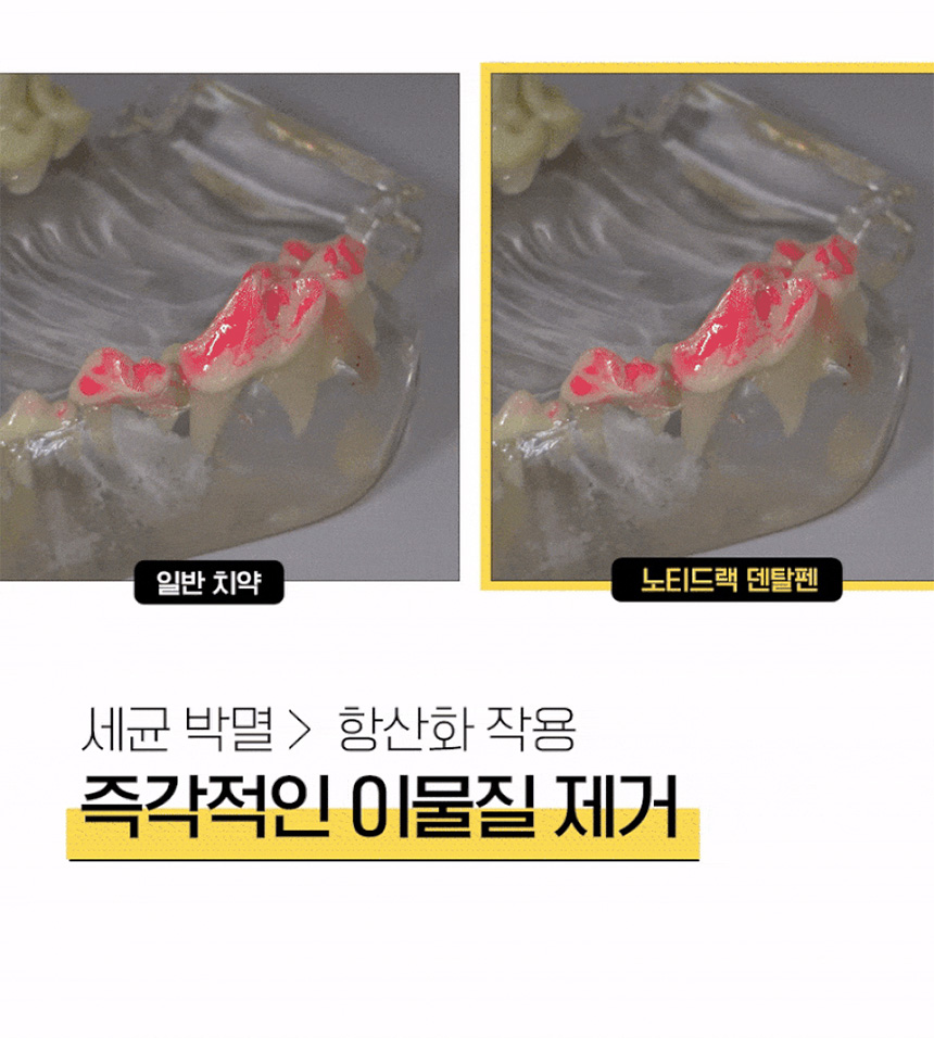 [NEW신상][무료배송] 베픈 프로폴리스 일체형 양치펜 닭고기맛 10번째