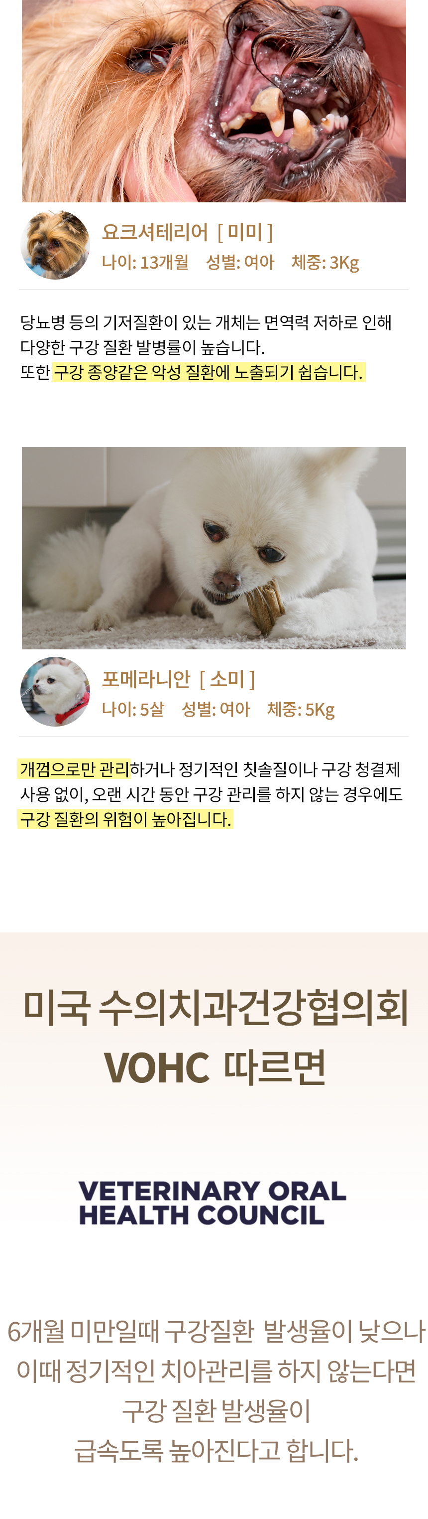 [무료배송] 디고 소프트화이버 클라우드 칫솔 2번째