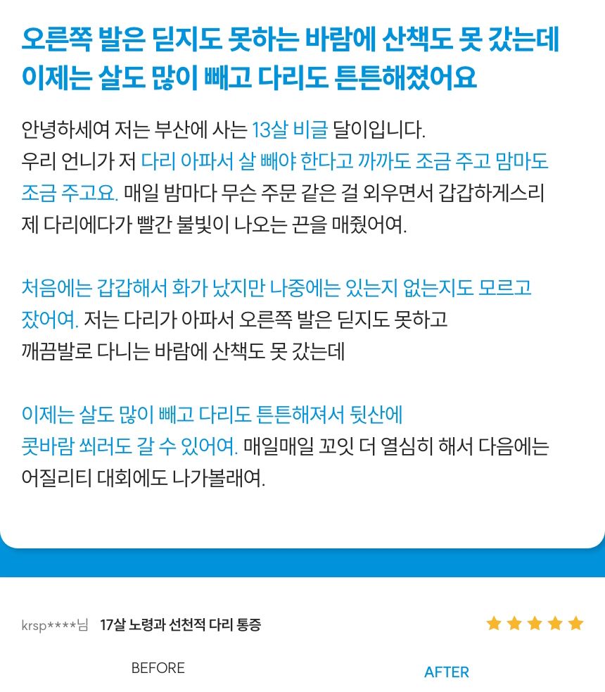 [무료배송] 꼬잇 독 슬개골 탈구 방지 보호대 V-ray Pro Therapy 홈케어 기기 빛단자 XS-M 11번째