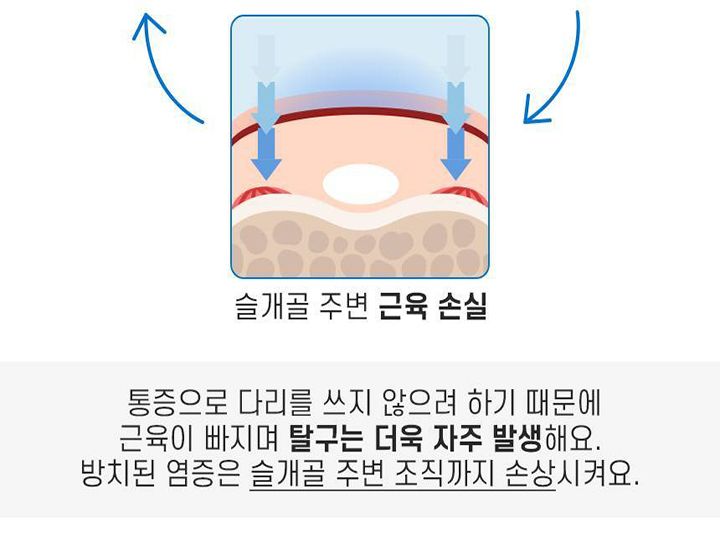 [무료배송] 꼬잇 독 슬개골 케어단자 1세트 (밴드 미포함)  14번째