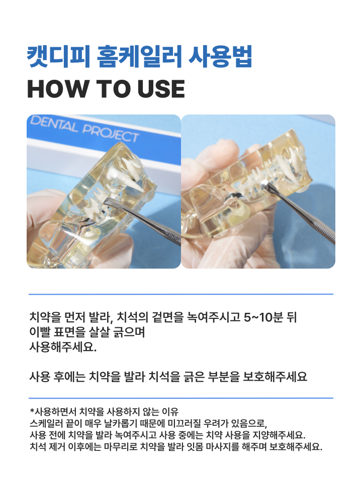 [NEW신상][무료배송] 캣디피 홈케일러 고양이 전용 치석제거기 40번째