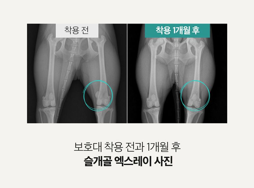 [무료배송] 포베오 슬개골 보호대 2단계 네오프린 블랙 XS-XL 13번째