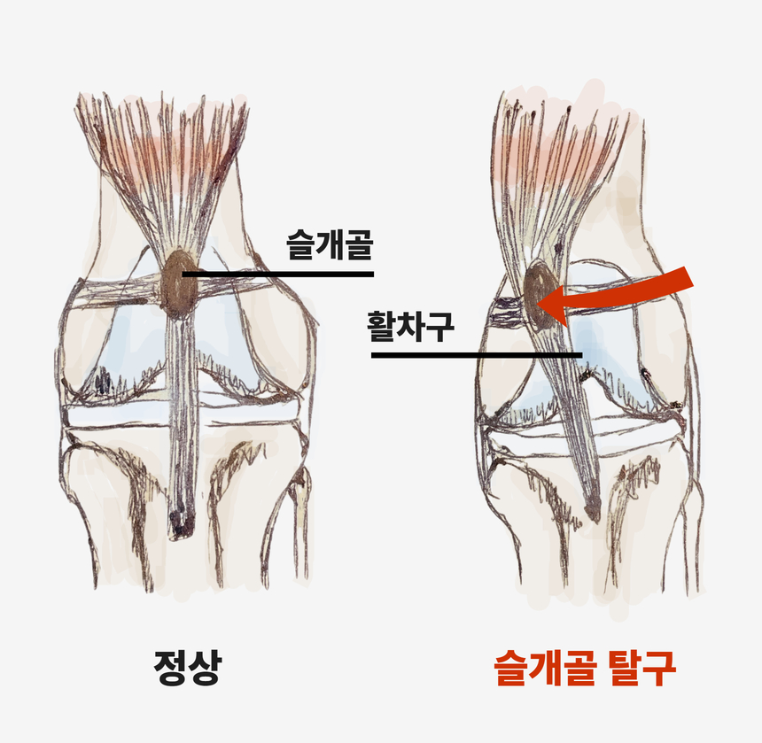 [무료배송] 잠보아 뉴트리페어 굿바이 조인트페인 180g 9번째