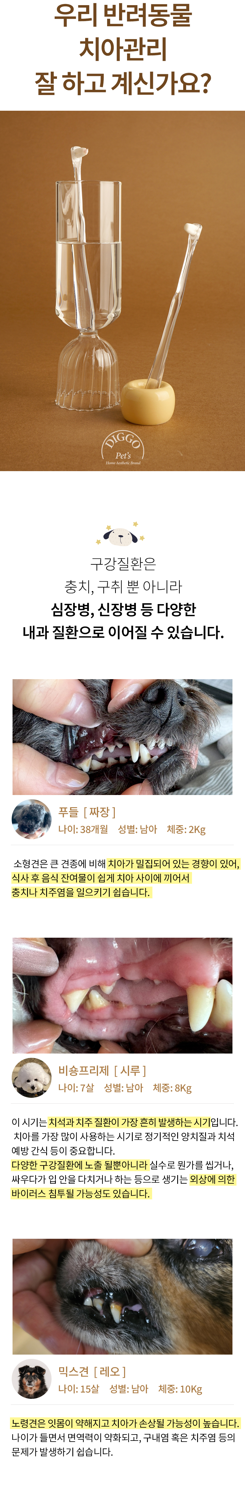 [NEW신상][무료배송] 디고 소프트화이버 클라우드 칫솔 1번째