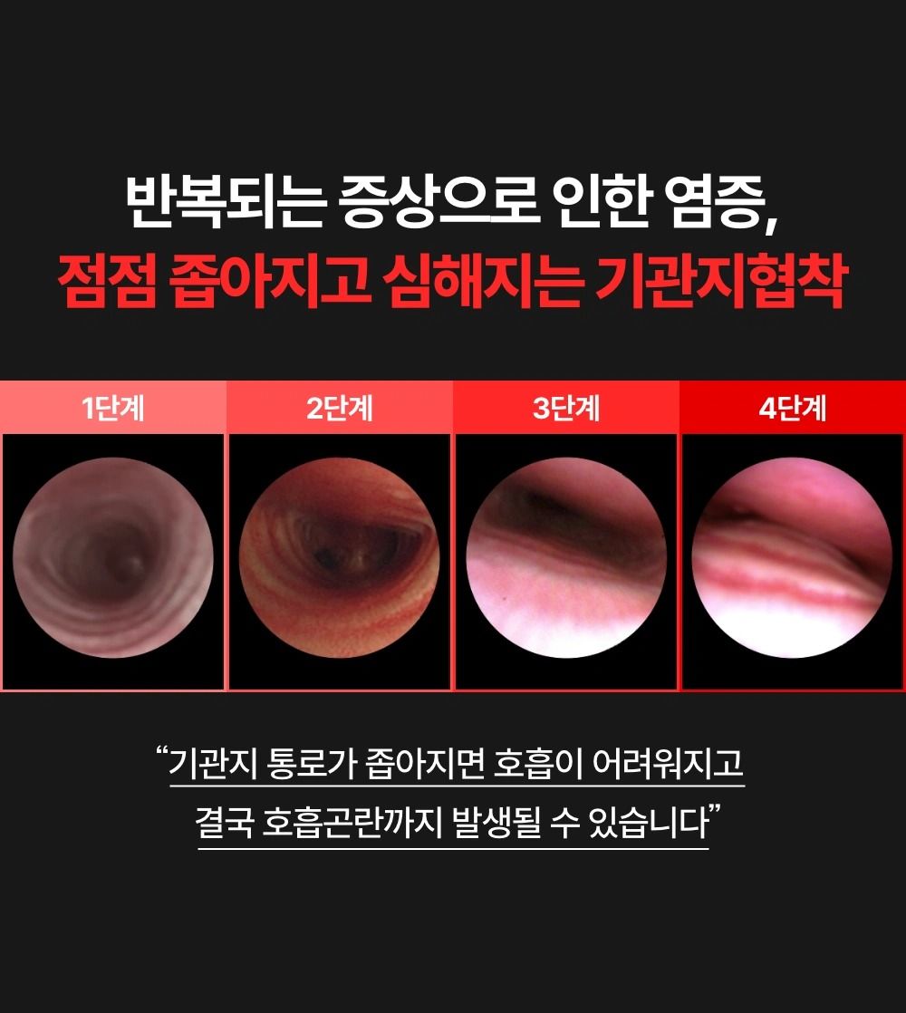 프로젝트21 기관지 협착증 영양제 퓨어 브레스 케어 7g*30p 5번째