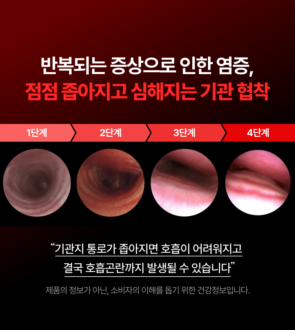 프로젝트21 기관지 협착증 영양제 퓨어 브레스 케어 7g*30p 4번째