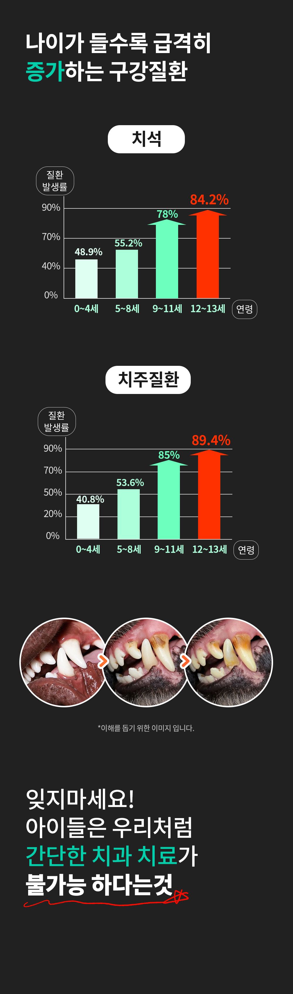 [무료배송] 파파메디 메디덴탈 치아 잇몸 영양제 치석제거 2g*30p 9번째