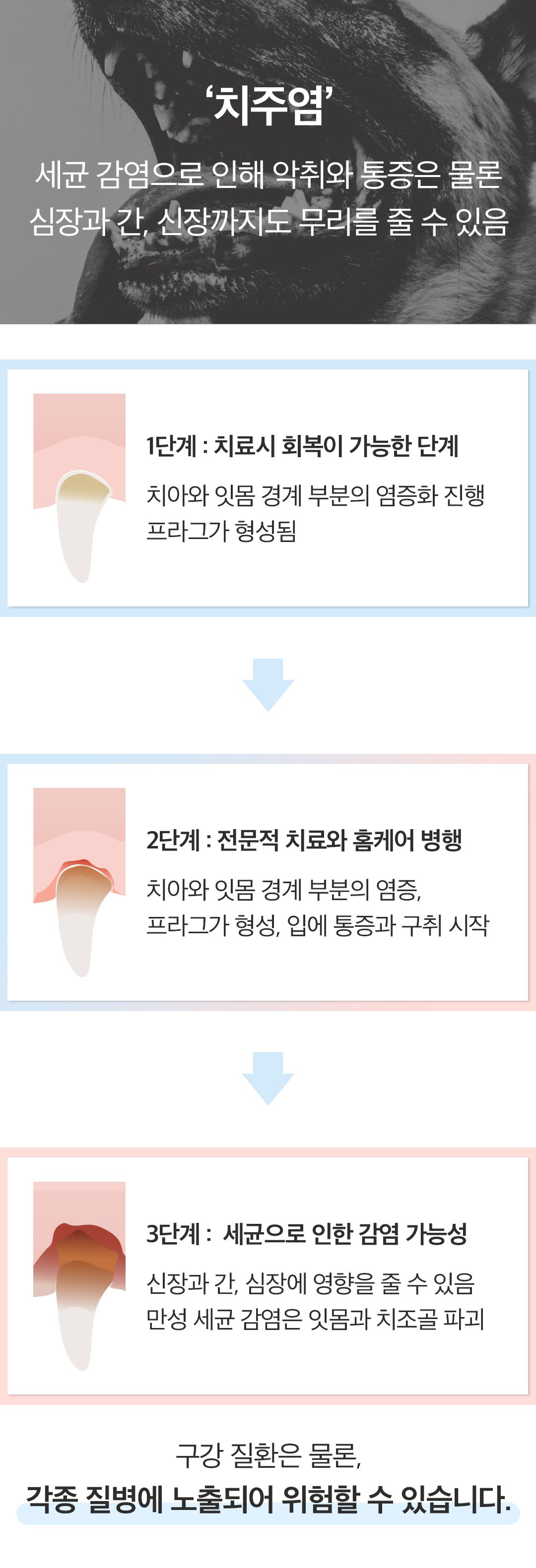[NEW신상]페디슨 덴탈케어 스케일러 15번째