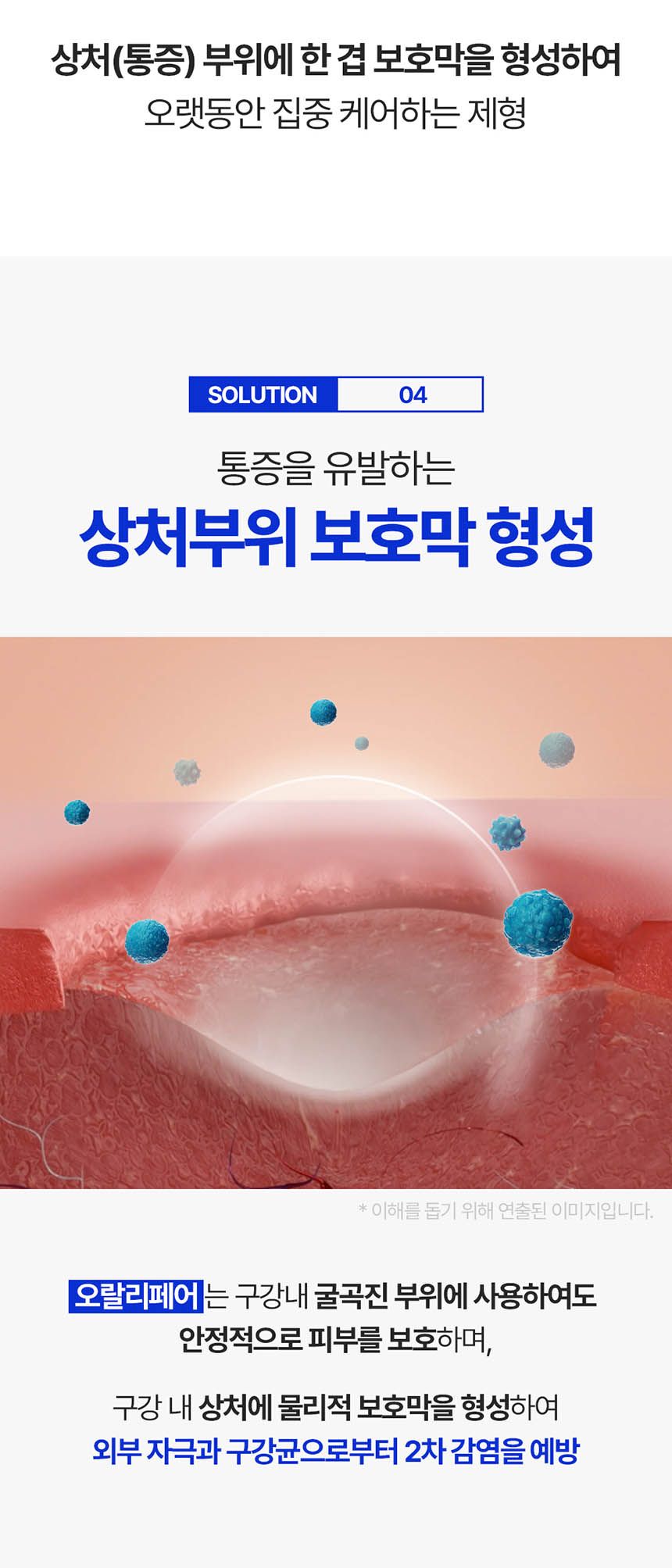 [NEW신상][무료배송] 프롬더셀 오랄리페어 구내염 겔타입 치료제 15g 25번째
