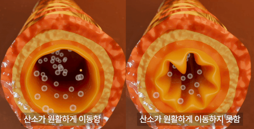 [무료배송] 코코다움 독 기관지 협착증 영양제 다시 편안 츄르 12g*30p 10번째