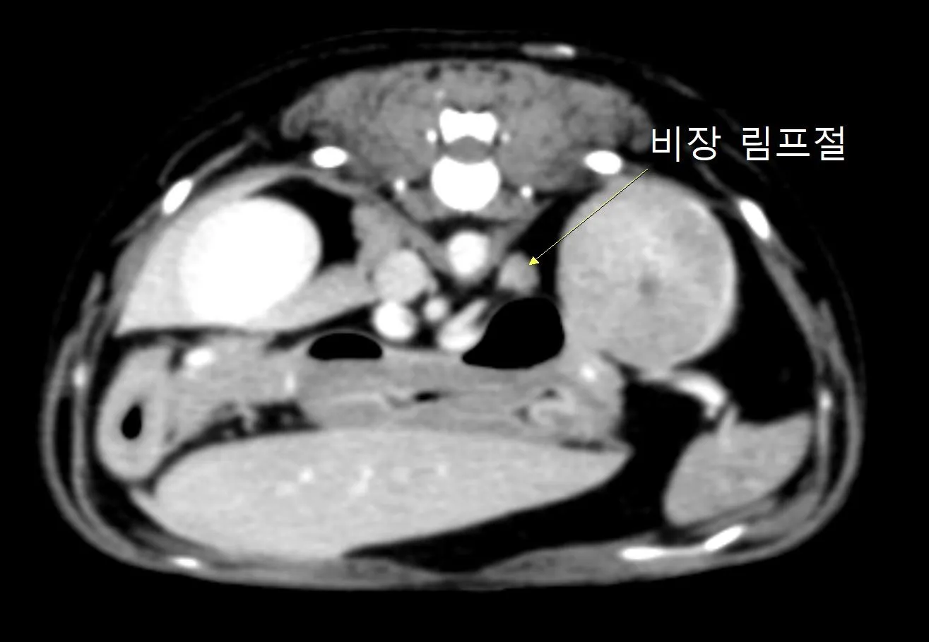 4번째 파일
