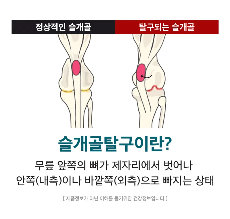[NEW신상][무료배송] 하루올데이 관절 기능성 유기농 수제 사료 1kg 2번째