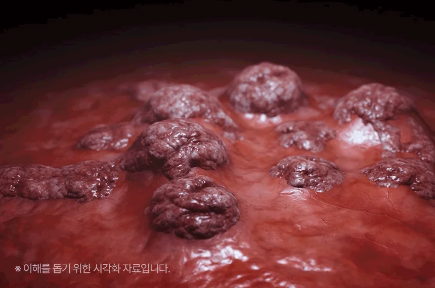 펫생각 임상완료 리포좀 후코이단 프로 씨놀  종합 항산화제 종양 항염 영양제 30정 28번째